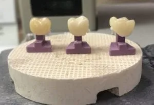 Perfect Pegs - Almost All Cool Dental Creations Ltd - Perfect Pegs - Almost All Cool