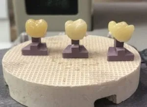 Perfect Pegs - Halfway Cooled Dental Creations Ltd - Perfect Pegs - Halfway Cooled