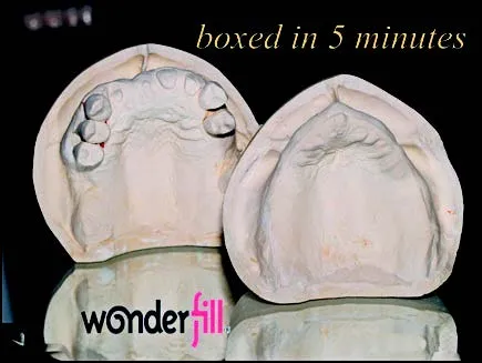 dlpMagazine-Jan2014-Zaleske1 Dental Creations, Ltd - Wonderfill Boxed in 5 Minutes