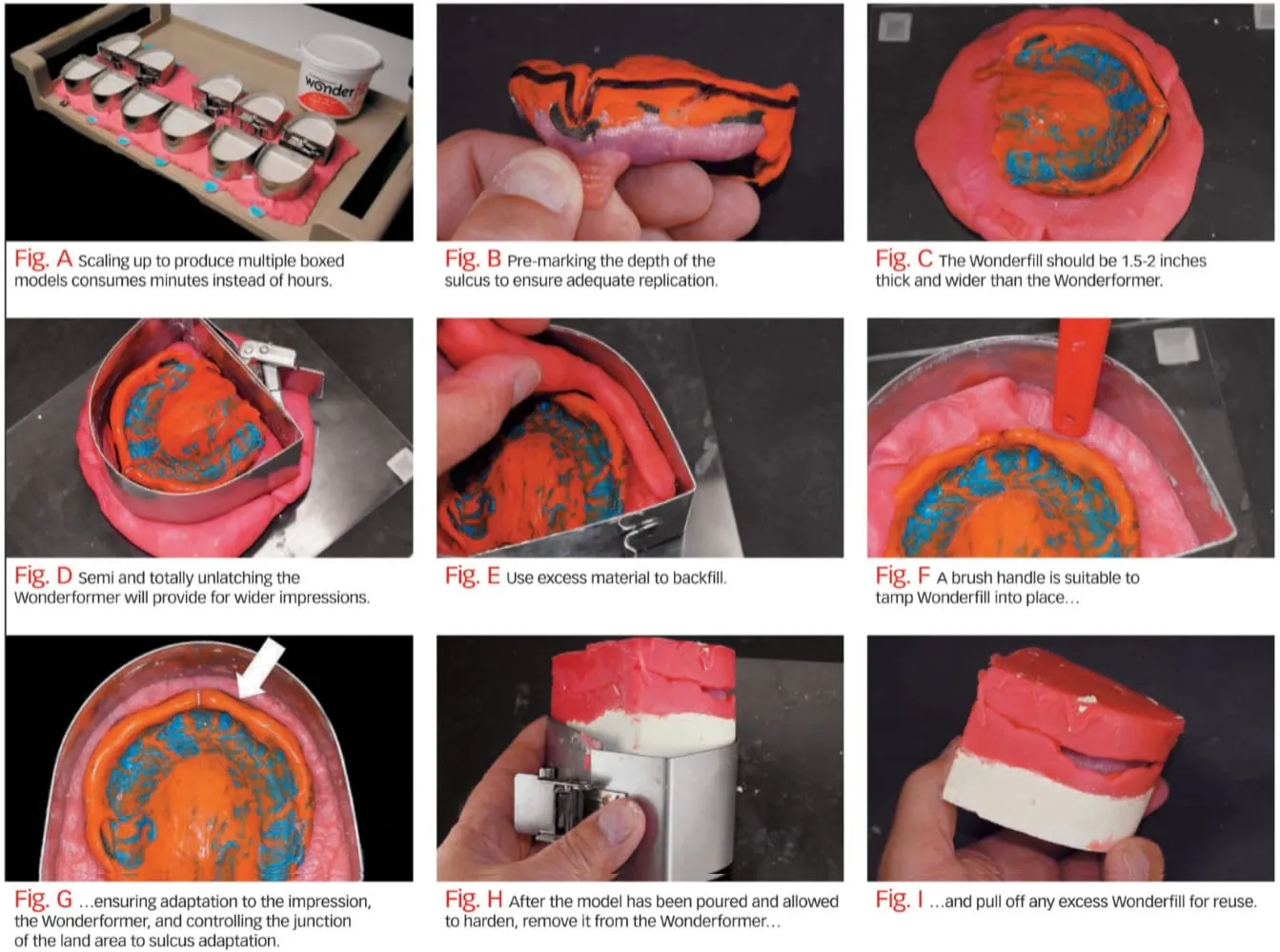 figures Dental Creations Ltd - Wonderfill & Wonderformers