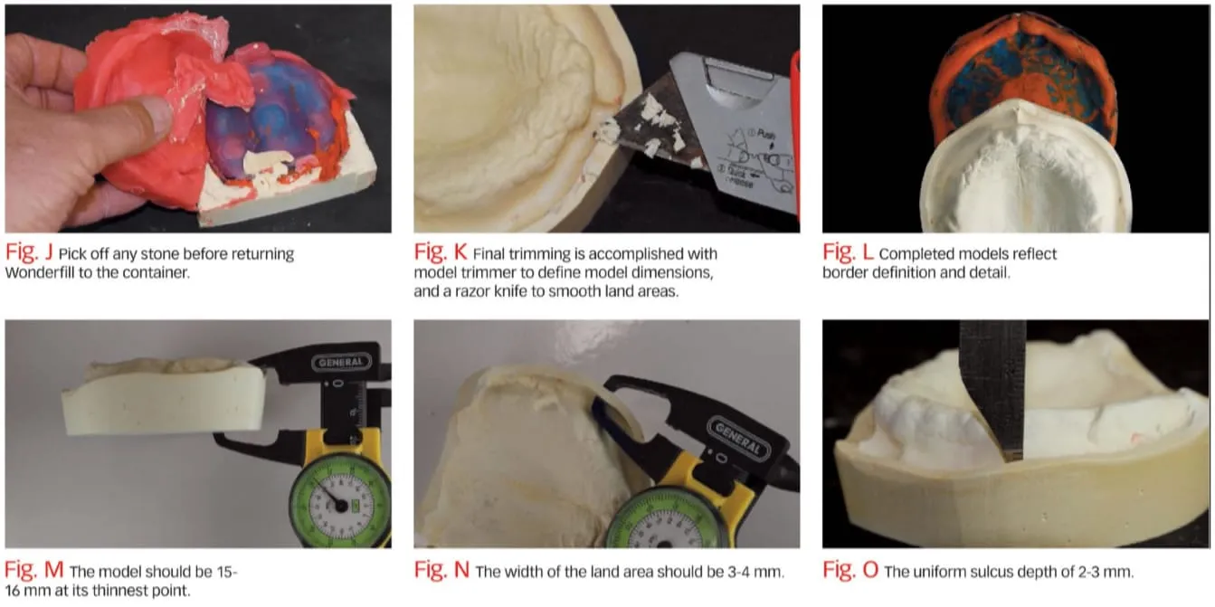 figures2 Dental Creations Ltd - Wonderfill & Wonderformer