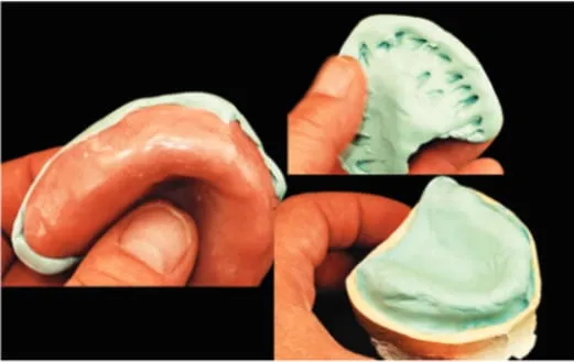 step5 Dental Creations, Ltd - Step 5