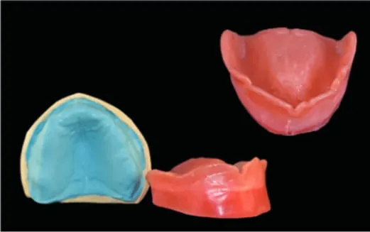step6 Dental Creations, Ltd - Step 6