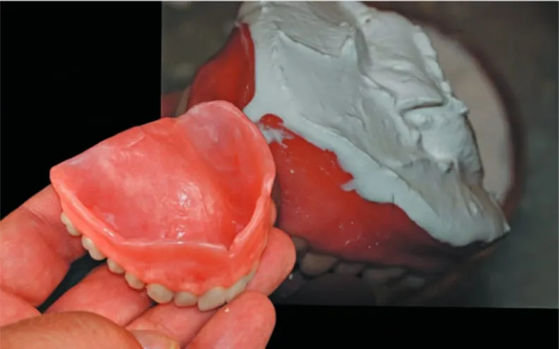 step7 Dental Creations, Ltd - Step 7