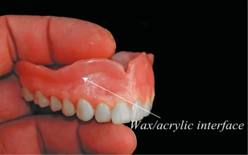step8 Dental Creations, Ltd - Step 8