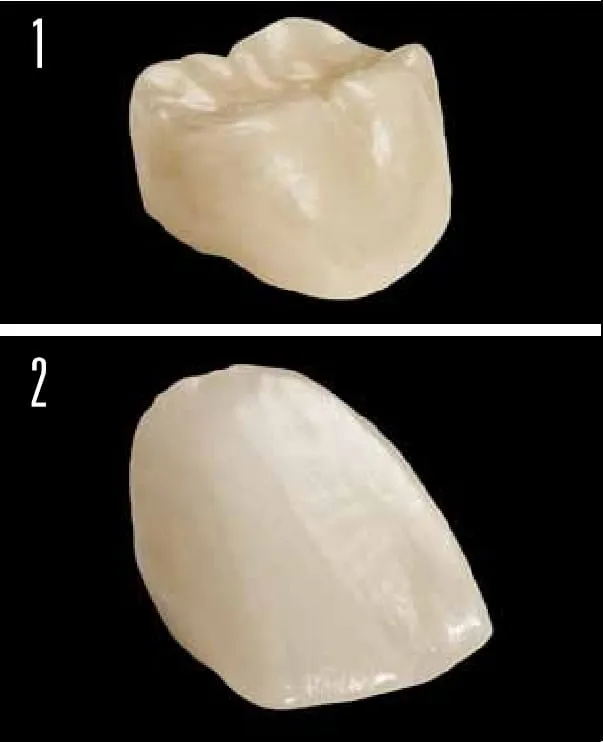gloss Dental Creations - To Glaze or Not to Glaze