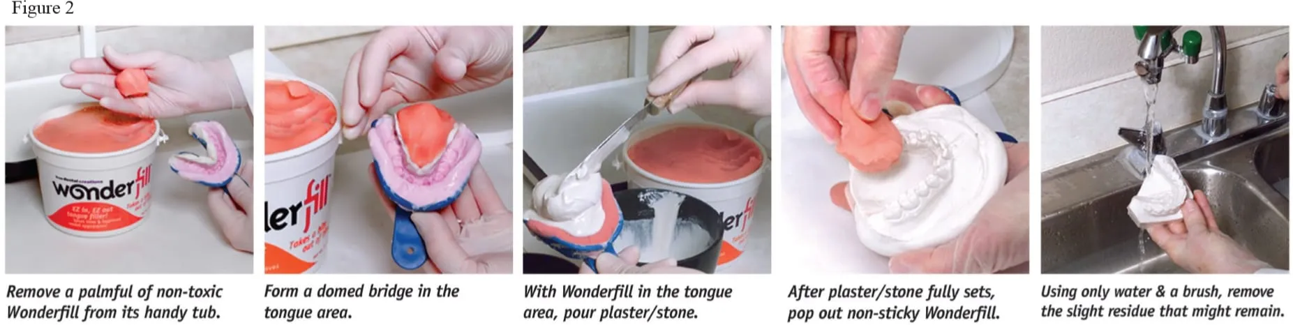 figure2 Dental Creations Ltd - Model Making Made EZ Article