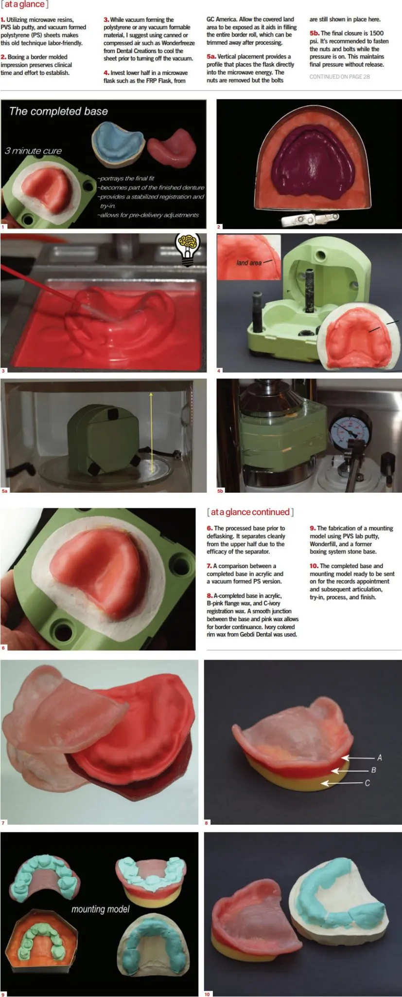 removables Dental Creations Dental Laboratory Products - Removables Article Figures