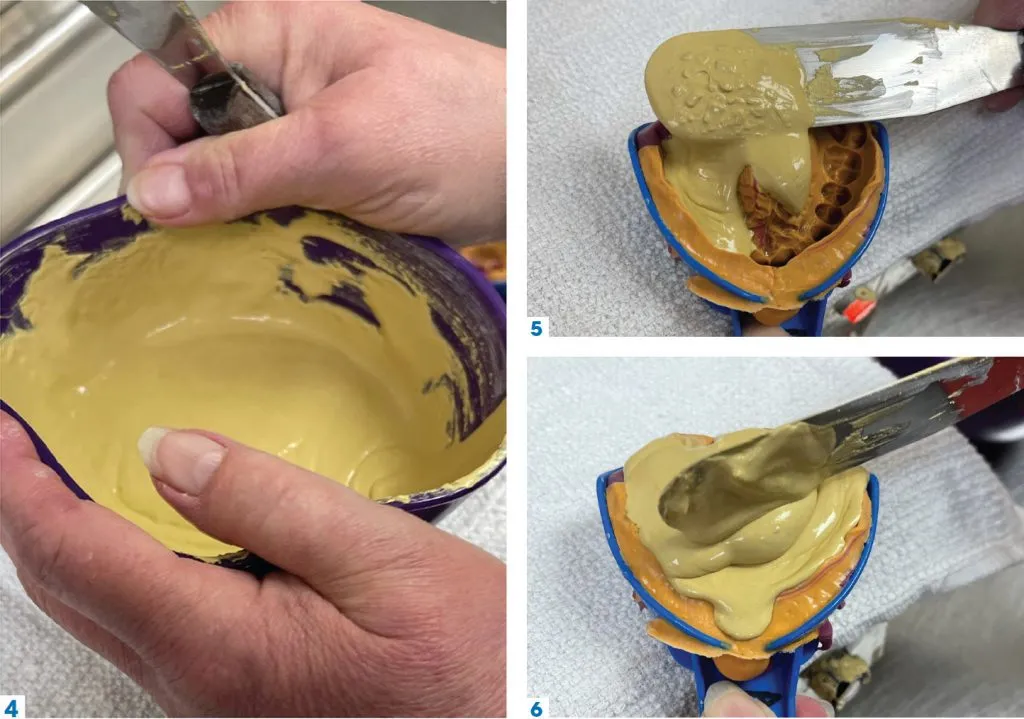 4-6 Burst the Bubbles in Your Dental Models - Figures 4 through 6